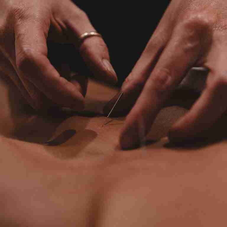 Acupuncture at Being