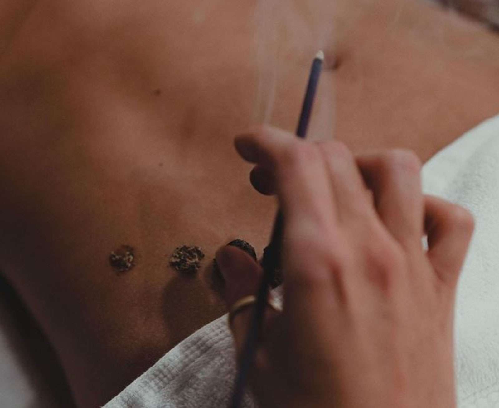 Moxibustion at Being, Coolangatta